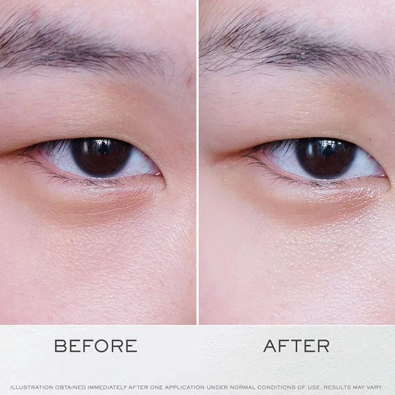 Lancome Advanced Genifique Yeux Youth Activating & Light Infusing Eye Cream, Lancome ,  Genifique Lancome, เซรั่มบำรุงดวงตา Lancôme,  อายครีม Lancome ,  อายครีม Lancome ราคา ,  อายครีม Lancome รีวิว